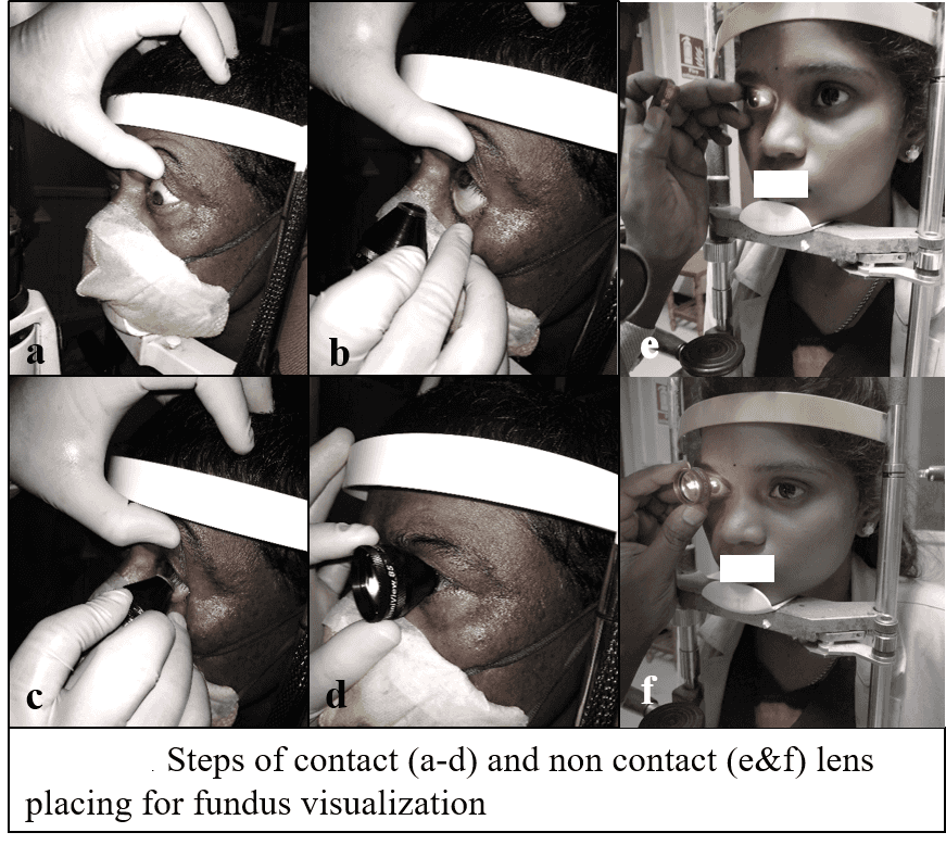 Imaging-and-Digital-Options